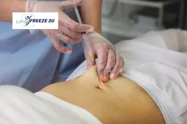 How Does Aqualyx Fat Dissolving Injection Work to Break Down Fat Derbyshire?