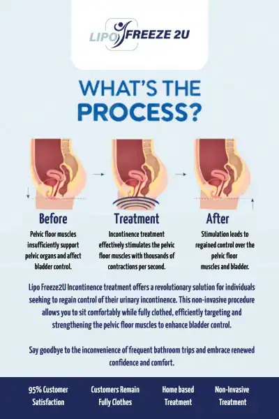 Diagram of how incontinence treatment Derbyshire works.
