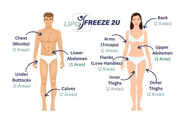 Areas you can have fat freezing treatment Derbyshire