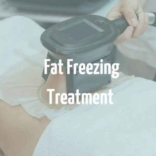 fat freezing treatment Derbyshire
