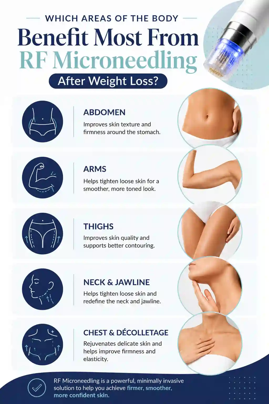 Which Areas of the Body Benefit Most From RF Microneedling After Weight Loss Derbyshire
